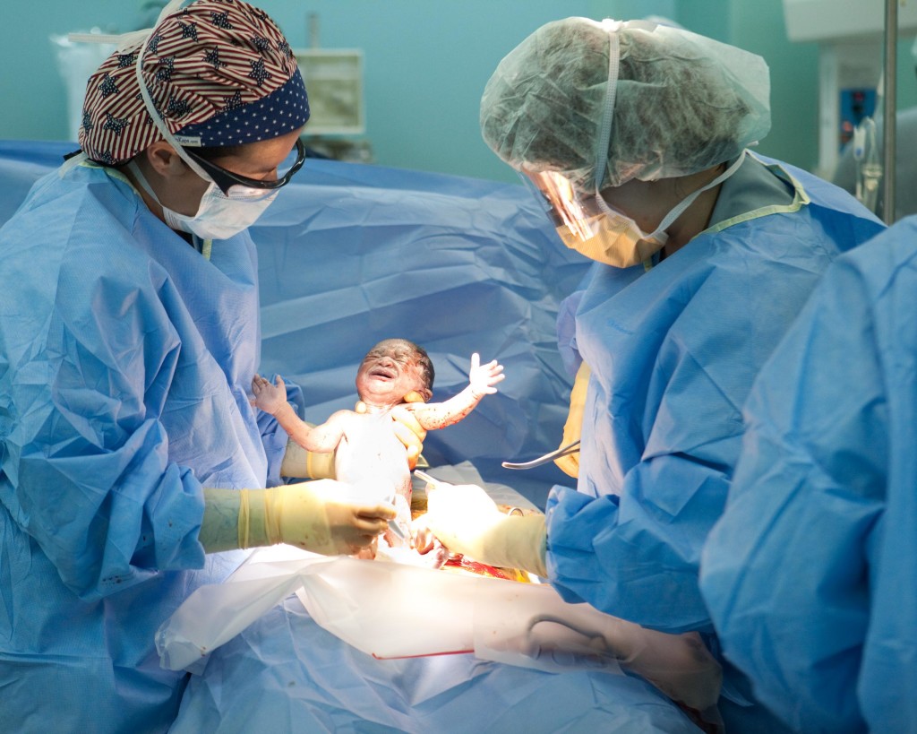 What everyone should know about Cesarean Birth - The Belle Method